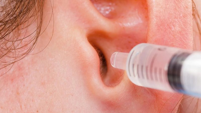 Hãy vệ sinh theo tai theo hàng ngày theo hướng dẫn của bác sĩ