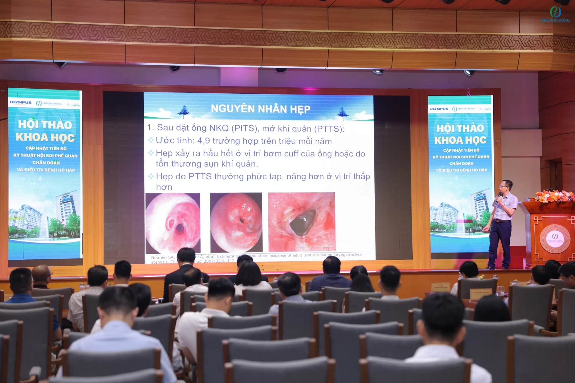 Đưa AI vào nội soi, bác sĩ chẩn đoán sớm ung thư phổi cùng nhiều bệnh lý hiếm gặp