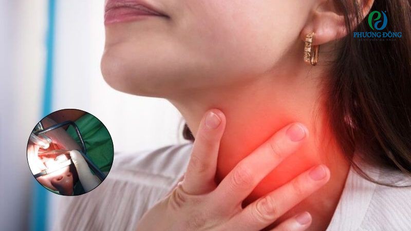 Các triệu chứng cần thận trọng sau khi cắt amidan vẫn đau