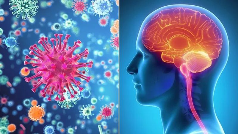 Viêm màng não là một trong số các biến chứng của thủ thuật đặt ốc tai