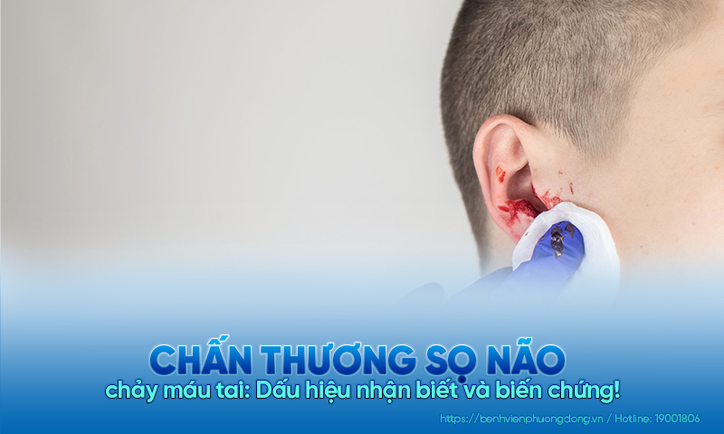 Chấn thương sọ não chảy máu tai: Dấu hiệu nhận biết và biến chứng