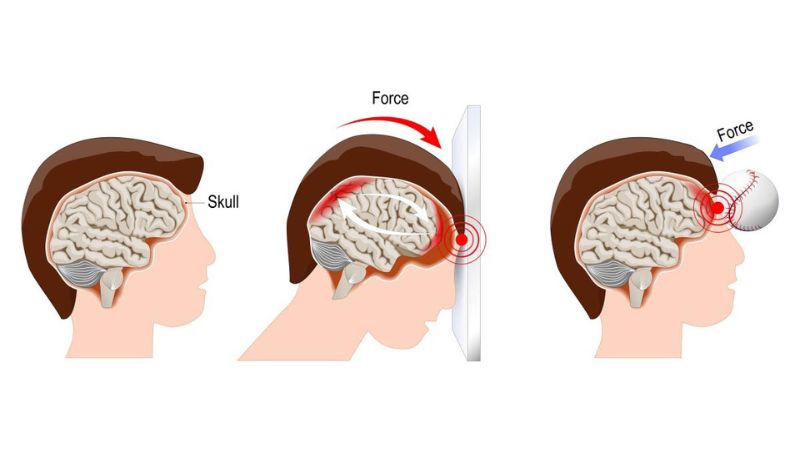 Trải qua va đập, tai có bị tổn thương khiến tai chảy máu