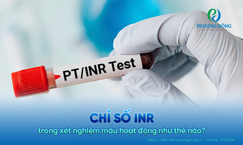 Chỉ số INR trong xét nghiệm máu hoạt động như thế nào?