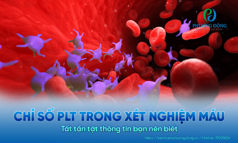 PLT trong xét nghiệm máu là gì? Tất tần tật thông tin bạn nên biết