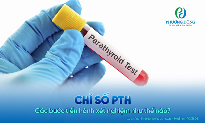 Chỉ số PTH là gì? Các bước tiến hành xét nghiệm như thế nào?