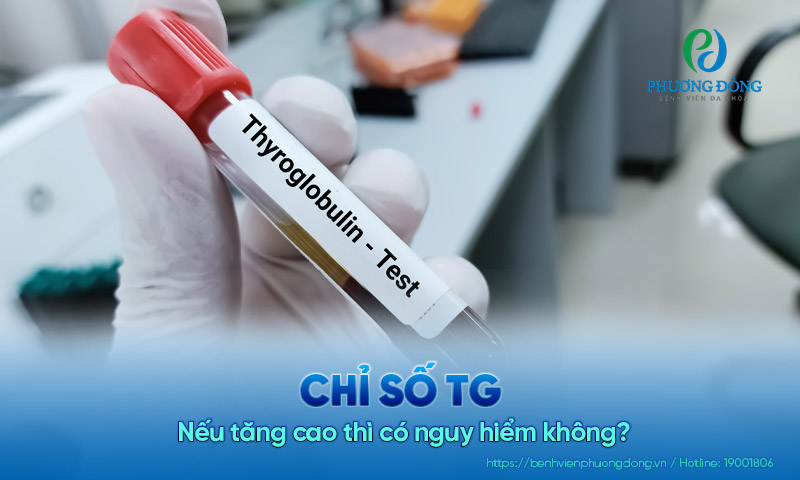 Chỉ số TG bình thường là bao nhiêu? Nếu tăng cao thì có nguy hiểm không?