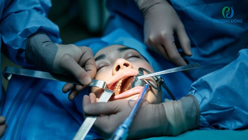 Có nên cắt amidan cho người lớn không? Nên cắt khi có chỉ định từ bác sĩ chuyên khoa