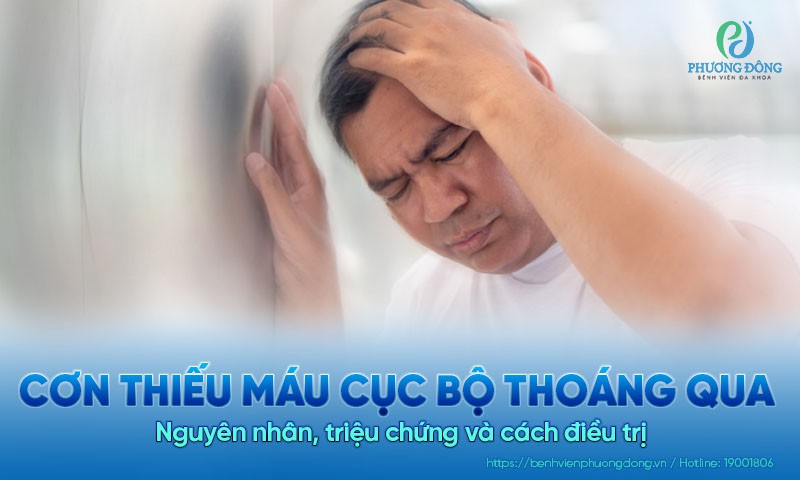 Cơn thiếu máu cục bộ thoáng qua (TIA): Nguyên nhân, triệu chứng và cách điều trị