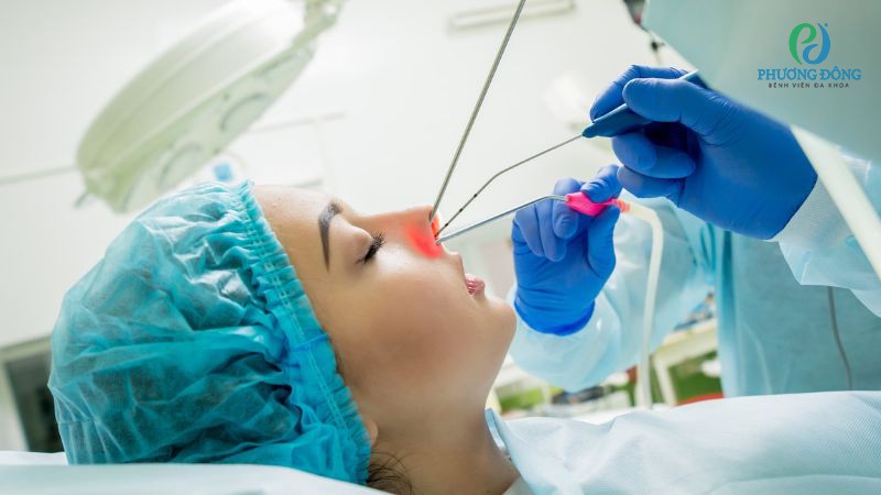 Một số phương pháp điều trị Concha Bullosa