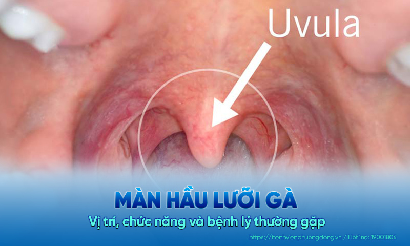 Màn hầu lưỡi gà: Vị trí, chức năng và bệnh lý thường gặp