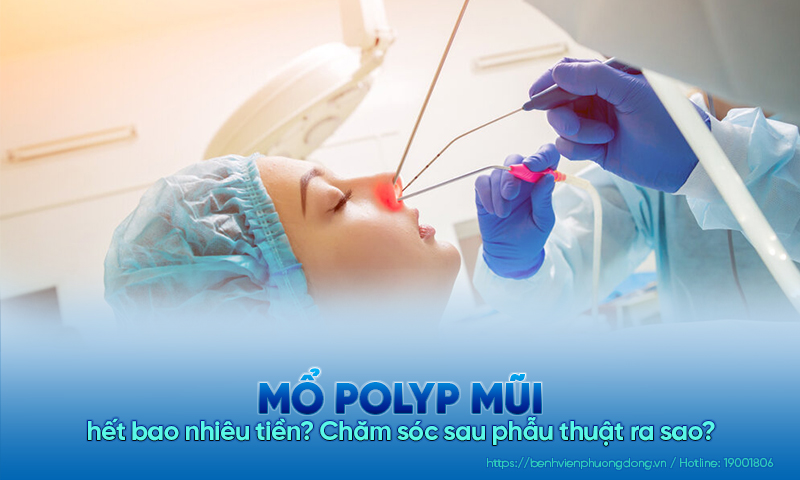 Mổ polyp mũi hết bao nhiêu tiền? Chăm sóc sau phẫu thuật ra sao?