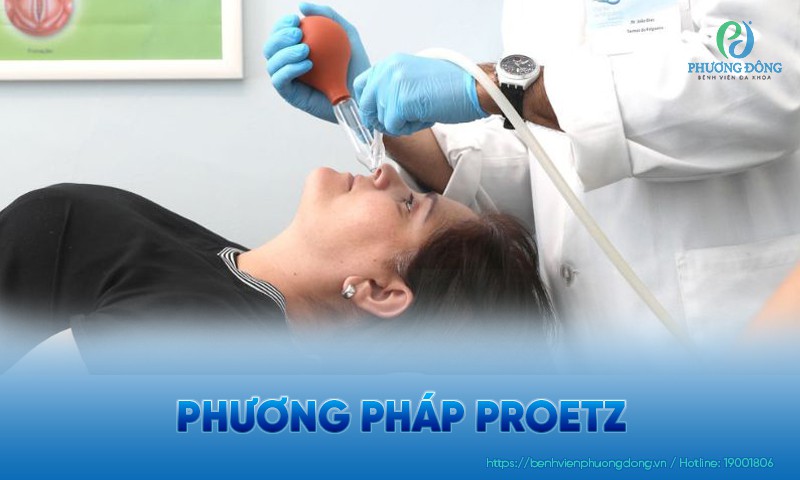 Phương pháp Proetz là gì? Ưu, nhược điểm của rửa xoang bằng Proetz