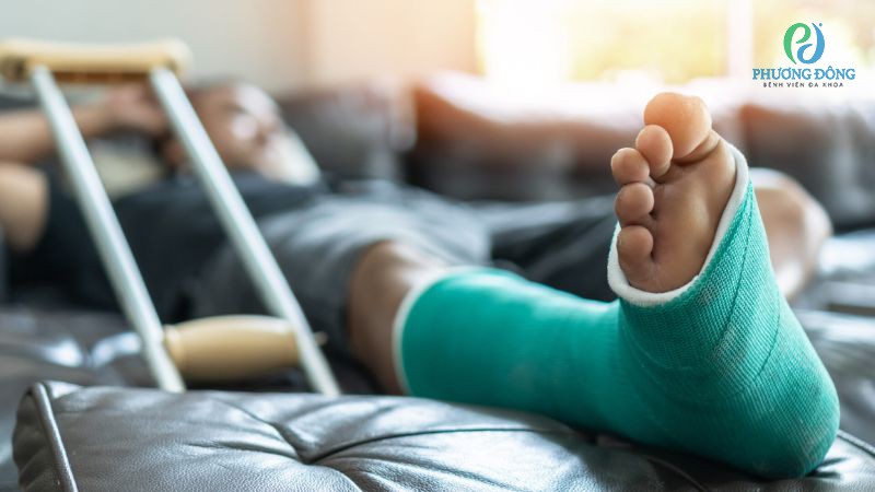 Can thiệp điều trị phẫu thuật với rạn xương mác