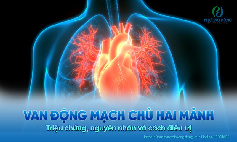 Van động mạch chủ hai mảnh: Nguyên nhân, triệu chứng và cách điều trị