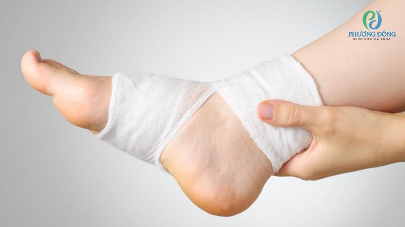 Rạn xương mắt cá chân bao lâu thì khỏi?