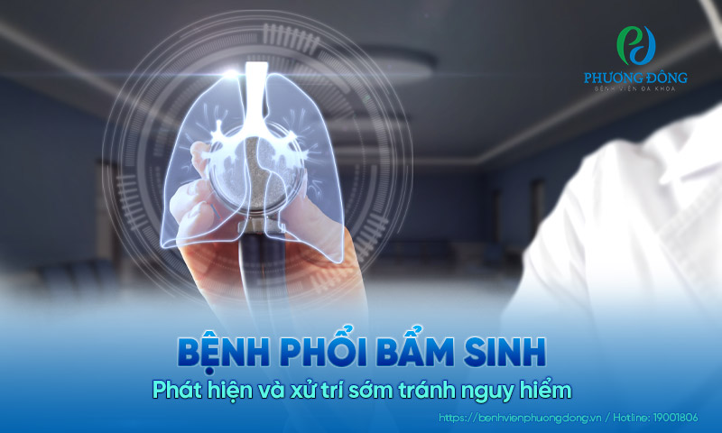 Bệnh phổi bẩm sinh: Cách phát hiện và xử trí sớm tránh nguy hiểm