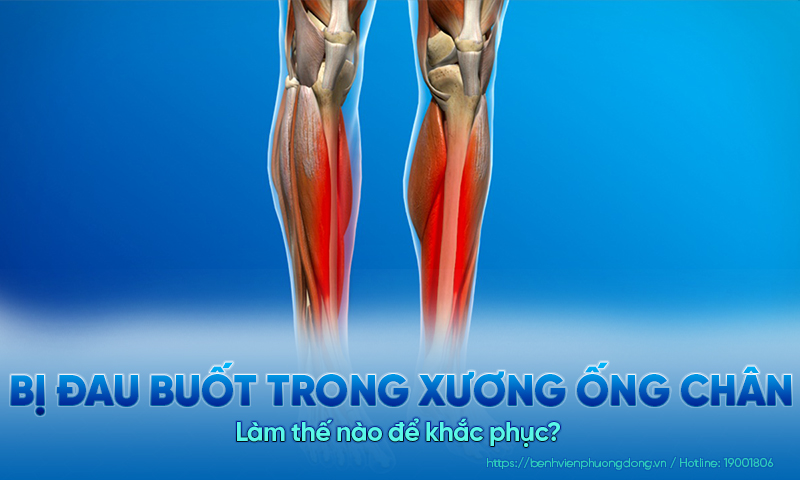 Vì sao bị đau buốt trong xương ống chân? Làm thế nào để khắc phục?  
