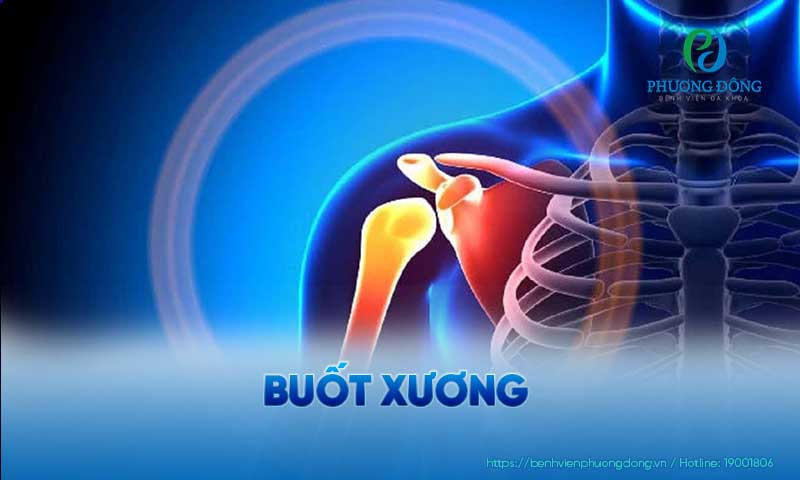 Đau nhức, thậm chí buốt ở xương là triệu chứng thường gặp