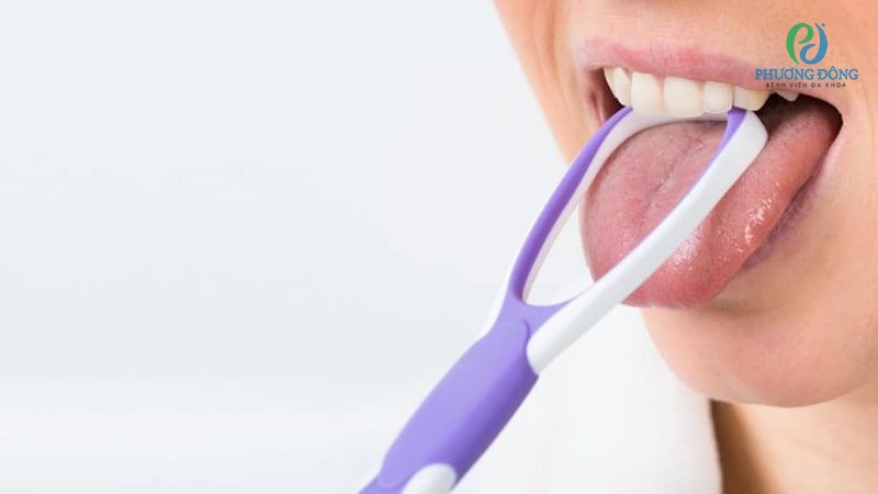 Cách làm sạch lưỡi bị trắng bằng dụng cụ chuyên dụng