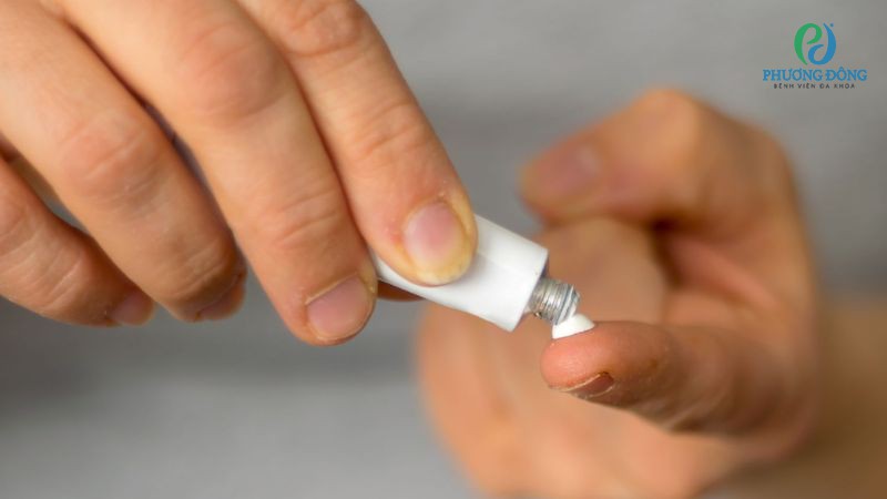 Dùng thuốc kê đơn để vệ sinh vùng lưỡi bị trắng bợt