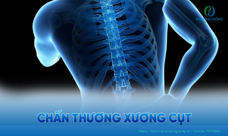 Chấn thương xương cụt: Triệu chứng, nguyên nhân và điều trị