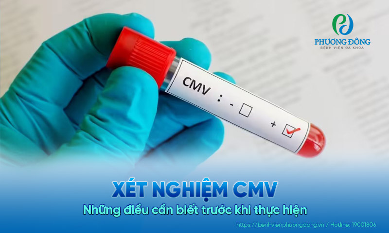 Xét nghiệm CMV là gì? Những điều cần biết trước khi thực hiện