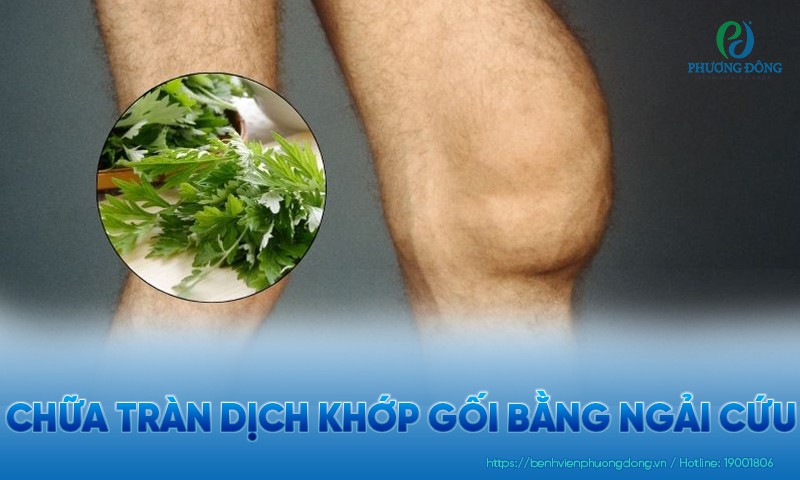 Chữa tràn dịch khớp gối bằng ngải cứu hiệu quả không?