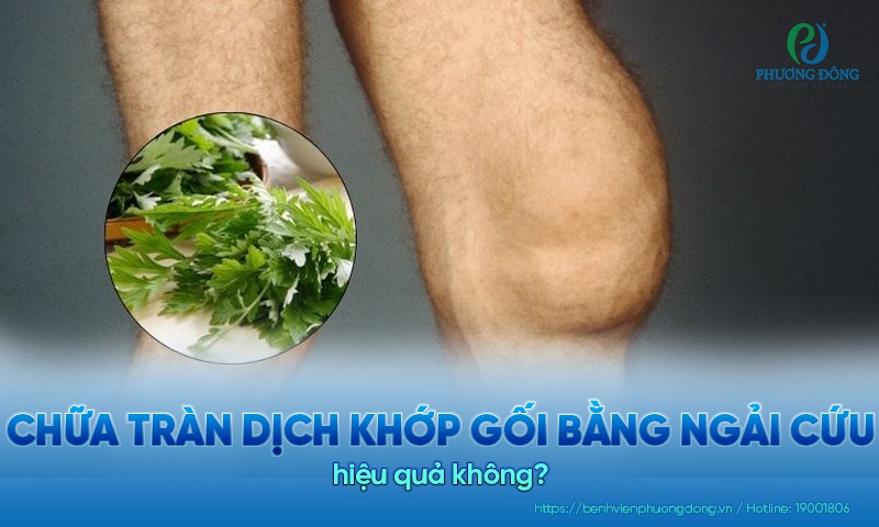 Dùng ngải cứu giúp lưu thông khí huyết, giảm ứ dịch do tràn dịch khớp gối