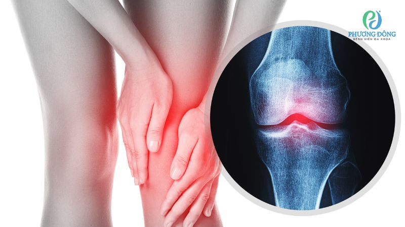 Một số bệnh lý khiến xương khớp bị đau nhức về đêm