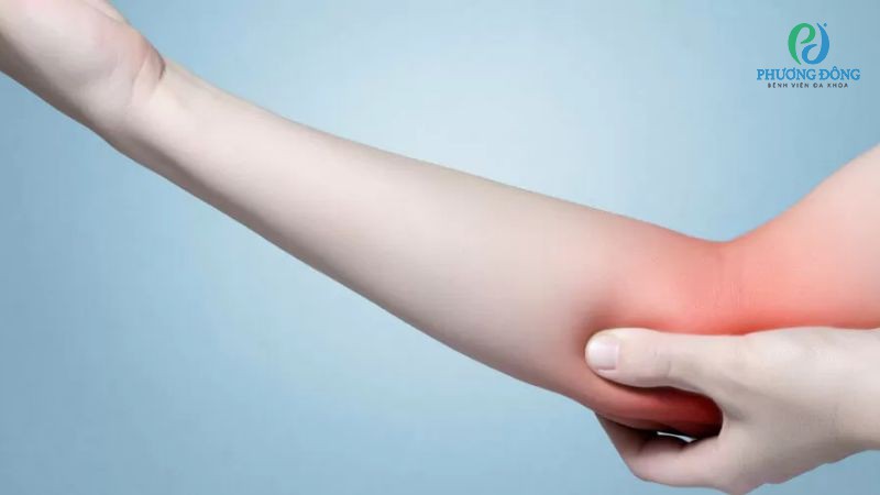 Biểu hiện lâm sàng khi thân xương cánh tay bị gãy