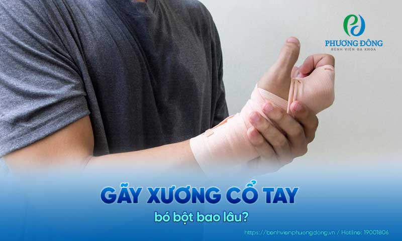 Gãy xương cổ tay bó bột bao lâu?