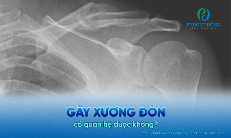 Gãy xương đòn có quan hệ được không?