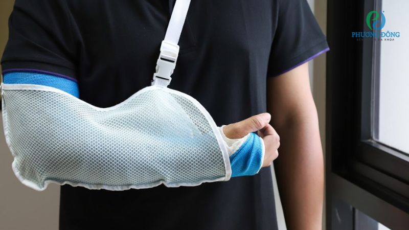 Lưu ý khi tập phục hồi chức năng gãy Galeazzi