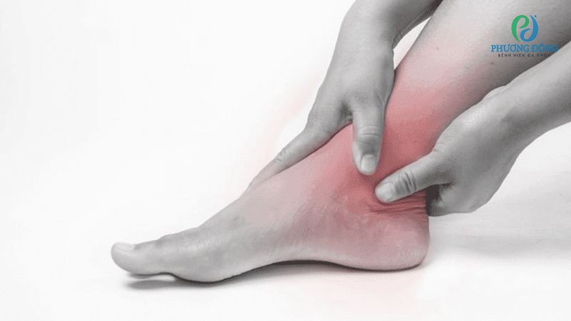 Nguy cơ biến chứng khi gãy xương cổ chân không được điều trị đúng các