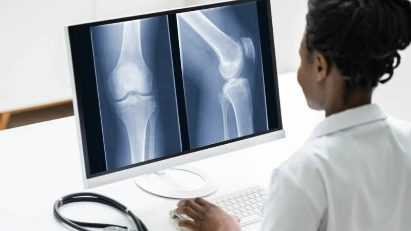 Người bệnh sẽ được chỉ định chụp X Quang để chẩn đoán