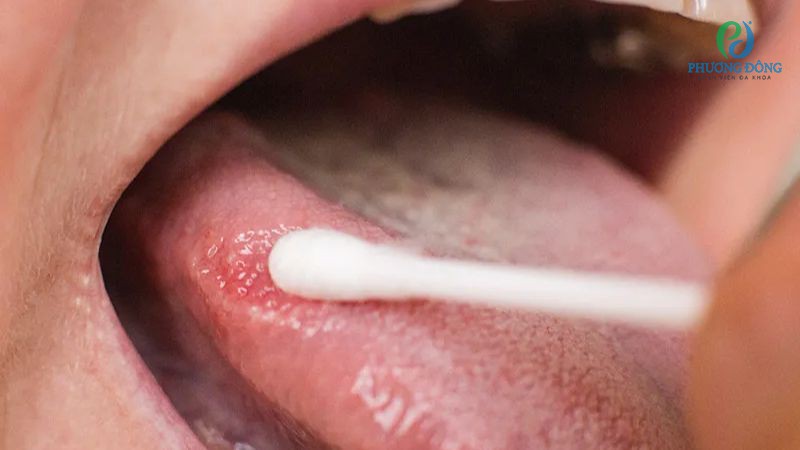 Can thiệp điều trị cần phụ thuộc vào nguyên nhân gây bệnh