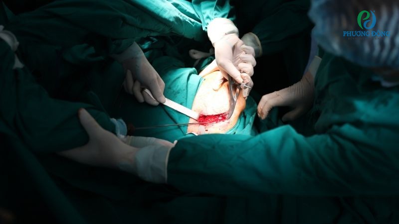 Điều trị Cơ - Xương - Khớp tại Bệnh viện Đa khoa Phương Đông