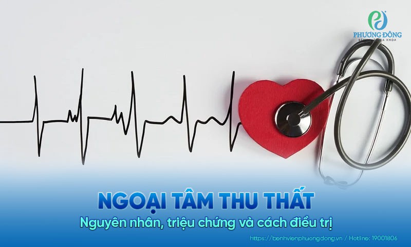 Ngoại tâm thu thất: Nguyên nhân, triệu chứng và cách điều trị