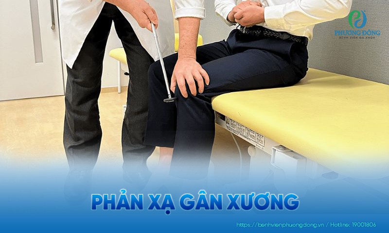 Phản xạ gân xương: Chỉ định, phương pháp và yếu tố ảnh hưởng