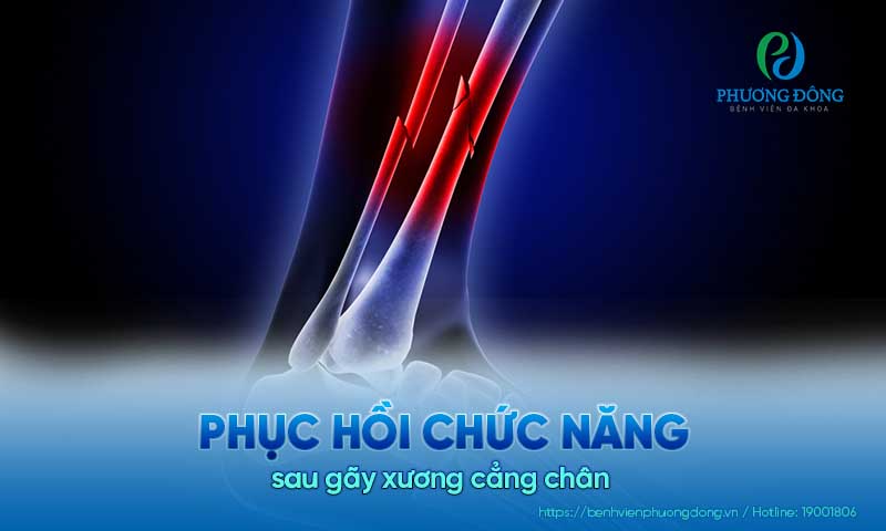 Phục hồi chức năng sau gãy xương cẳng chân như thế nào?