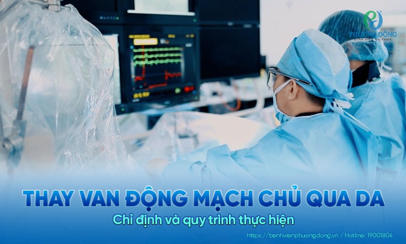 Thay van động mạch chủ qua da: Chỉ định và quy trình