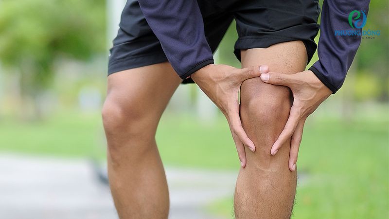 Ba nguyên nhân chính gây nên tình trạng tràn dịch đầu gối