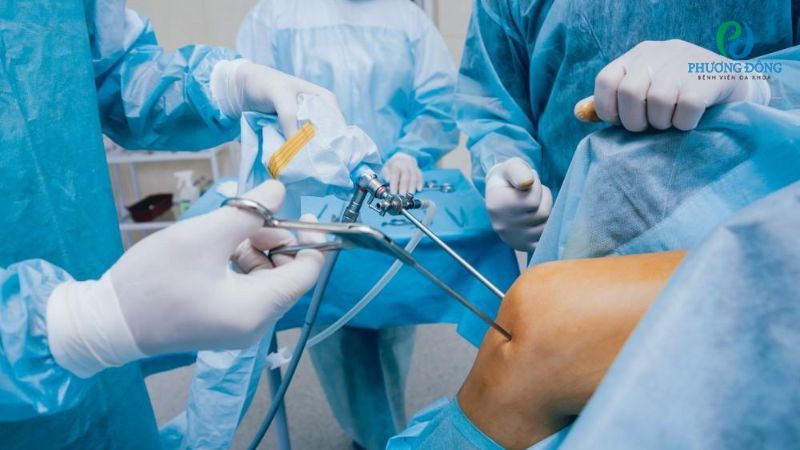 Điều trị bằng phương pháp nội soi khớp