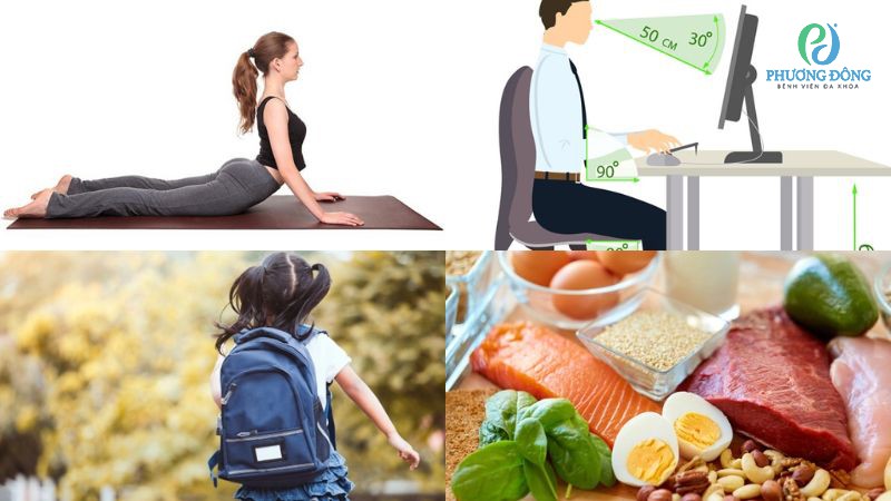 Chủ động phòng ngừa vẹo xương cột sống