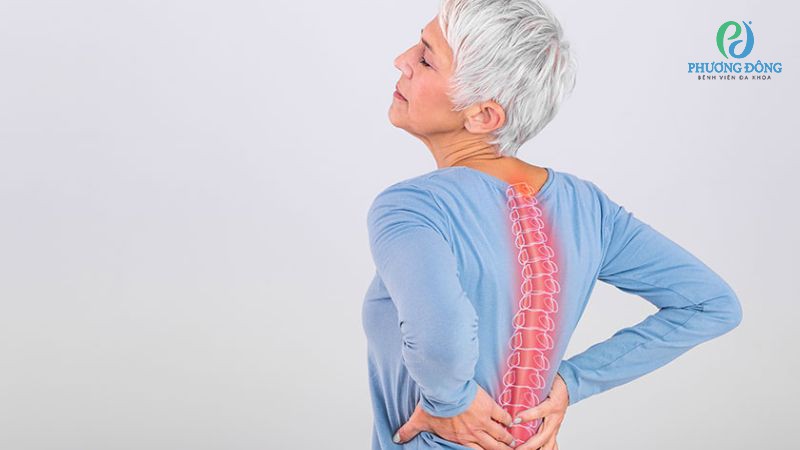 Thoái hoá xương khớp ở người già có thể làm xương sống bị cong