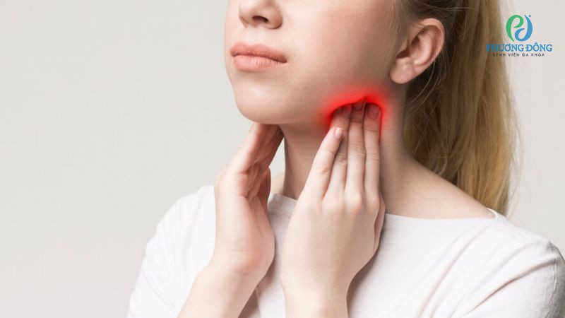 Viêm amidan sưng hạch cần được điều trị dứt điểm