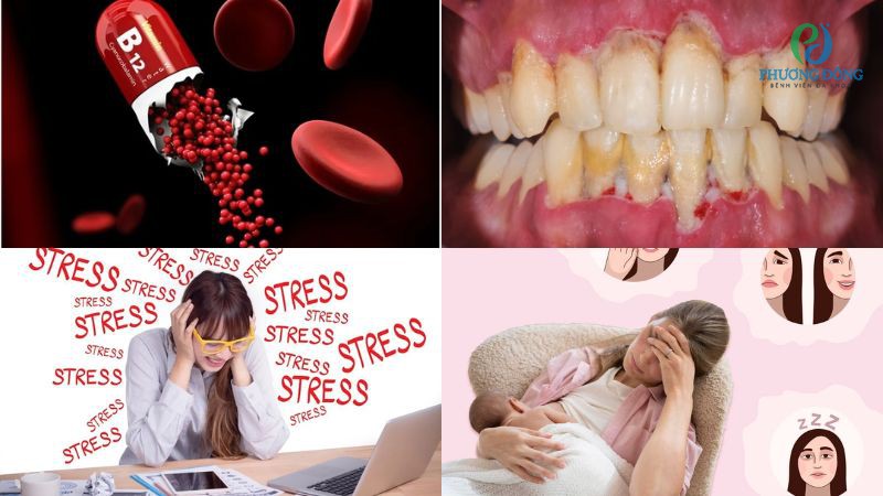 Tác nhân khiến gai lưỡi bị viêm nhiễm khó chịu