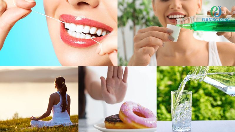 Một số hướng điều trị viêm gai lưỡi chuyên sâu