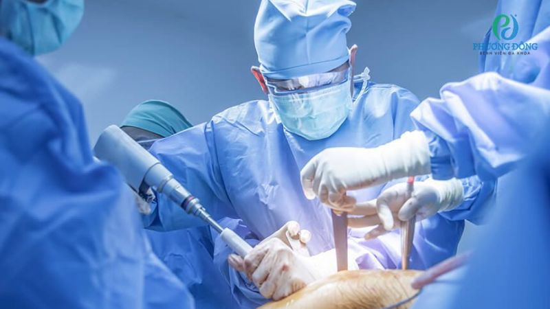 Phẫu thuật khi điều trị nội khoa, bảo tồn viêm khớp tràn dịch không đạt hiệu quả