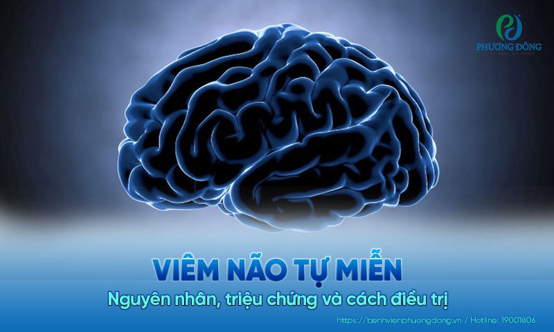 Viêm não tự miễn: Nguyên nhân, triệu chứng và cách điều trị bệnh